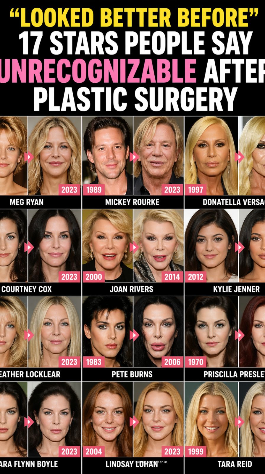Split image showing celebrity before and after facial transformations highlighting changes in lips, jawline, and overall appearance due to cosmetic procedures.